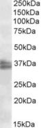 Protein FRG1 antibody, NBP1-49864, Novus Biologicals, Western Blot image 