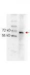 p65 antibody, TA319553, Origene, Western Blot image 