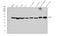 Proteasome 26S Subunit, ATPase 3 antibody, M07208-2, Boster Biological Technology, Western Blot image 