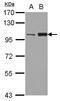 Kinesin Family Member 3C antibody, LS-C155337, Lifespan Biosciences, Western Blot image 