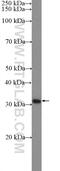 Homeobox D9 antibody, 20560-1-AP, Proteintech Group, Western Blot image 