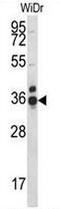 Coiled-Coil Domain Containing 90B antibody, AP50797PU-N, Origene, Western Blot image 