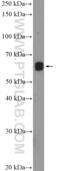 PHD Finger Protein 1 antibody, 15663-1-AP, Proteintech Group, Western Blot image 