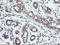 Ring Finger Protein 113B antibody, LS-C173651, Lifespan Biosciences, Immunohistochemistry paraffin image 