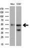 Forkhead Box O4 antibody, LS-C791740, Lifespan Biosciences, Western Blot image 