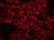Replication Protein A2 antibody, IHC-00422, Bethyl Labs, Immunohistochemistry paraffin image 