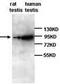 DGCR8 Microprocessor Complex Subunit antibody, TA310111, Origene, Western Blot image 