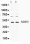 Heterogeneous nuclear ribonucleoprotein H antibody, A07691, Boster Biological Technology, Western Blot image 