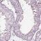 Leucine Rich Repeats And IQ Motif Containing 3 antibody, NBP1-92078, Novus Biologicals, Immunohistochemistry paraffin image 
