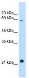 Rbpl antibody, TA335630, Origene, Western Blot image 