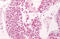 PTGES antibody, MBS240155, MyBioSource, Immunohistochemistry paraffin image 