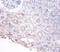Phosphoglycerate Dehydrogenase antibody, A51657-100, Epigentek, Immunohistochemistry paraffin image 