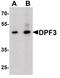 Zinc finger protein DPF3 antibody, PA5-38011, Invitrogen Antibodies, Western Blot image 