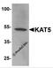 Histone acetyltransferase KAT5 antibody, 7339, ProSci Inc, Western Blot image 