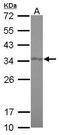LRAT Domain Containing 1 antibody, PA5-30705, Invitrogen Antibodies, Western Blot image 