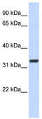 Homeobox protein Nkx-2.5 antibody, TA329339, Origene, Western Blot image 