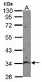Mitochondrial Calcium Uniporter Regulator 1 antibody, NBP2-15755, Novus Biologicals, Western Blot image 