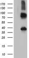 Integral Membrane Protein 2A antibody, TA811876S, Origene, Western Blot image 