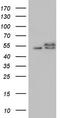 RAD23 Homolog B, Nucleotide Excision Repair Protein antibody, TA804864, Origene, Western Blot image 