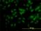 Putative SCAN domain-containing protein 2 antibody, H00054581-M01, Novus Biologicals, Immunocytochemistry image 