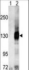 CASK antibody, LS-C100739, Lifespan Biosciences, Western Blot image 