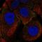 Q3UKK2 antibody, HPA019758, Atlas Antibodies, Immunocytochemistry image 