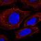 Solute Carrier Family 7 Member 11 antibody, NBP2-56446, Novus Biologicals, Immunocytochemistry image 