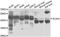 Acetyl-CoA Acyltransferase 1 antibody, A7422, ABclonal Technology, Western Blot image 