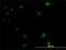 Ubiquitin Conjugating Enzyme E2 M antibody, H00009040-M01, Novus Biologicals, Immunocytochemistry image 