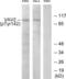 Vav Guanine Nucleotide Exchange Factor 2 antibody, LS-C199715, Lifespan Biosciences, Western Blot image 
