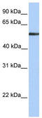 Alpha-L-Fucosidase 1 antibody, TA336245, Origene, Western Blot image 