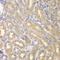 Interleukin 12 Receptor Subunit Beta 1 antibody, LS-C335191, Lifespan Biosciences, Immunohistochemistry paraffin image 