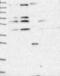 Ras-GRF1 antibody, NBP1-85727, Novus Biologicals, Western Blot image 