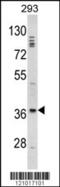 Homeobox protein DLX-2 antibody, 62-520, ProSci, Western Blot image 