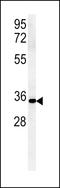 Zinc Finger DHHC-Type Containing 2 antibody, LS-C160752, Lifespan Biosciences, Western Blot image 