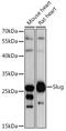 Snail Family Transcriptional Repressor 2 antibody, GTX32879, GeneTex, Western Blot image 
