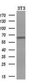 Iduronate 2-Sulfatase antibody, MA5-25855, Invitrogen Antibodies, Western Blot image 