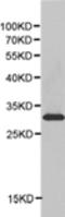 Peroxiredoxin 4 antibody, TA321764, Origene, Western Blot image 