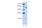 Zinc Finger CCCH-Type, RNA Binding Motif And Serine/Arginine Rich 2 antibody, A06761, Boster Biological Technology, Western Blot image 