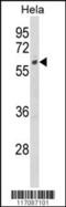 Cytochrome P450 Family 7 Subfamily B Member 1 antibody, 63-643, ProSci, Western Blot image 