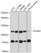Electrogenic sodium bicarbonate cotransporter 4 antibody, GTX64690, GeneTex, Western Blot image 