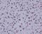 p53BP1 antibody, M00397, Boster Biological Technology, Immunohistochemistry paraffin image 