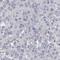 RAD54 Like antibody, HPA028954, Atlas Antibodies, Immunohistochemistry paraffin image 