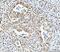 p53BP1 antibody, A00397, Boster Biological Technology, Immunohistochemistry paraffin image 