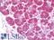 Derlin 2 antibody, LS-B10528, Lifespan Biosciences, Immunohistochemistry paraffin image 