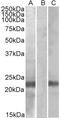 Cystatin-8 antibody, STJ72135, St John