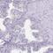 Dynein Axonemal Heavy Chain 9 antibody, PA5-62656, Invitrogen Antibodies, Immunohistochemistry frozen image 