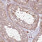 D-Aminoacyl-TRNA Deacylase 2 antibody, HPA001117, Atlas Antibodies, Immunohistochemistry paraffin image 