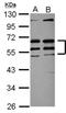 SS18L1 Subunit Of BAF Chromatin Remodeling Complex antibody, NBP2-20486, Novus Biologicals, Western Blot image 