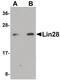 LIN28A antibody, PA5-20898, Invitrogen Antibodies, Western Blot image 